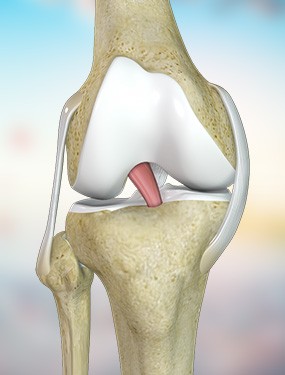 ACL Knee
                                                Reconstruction