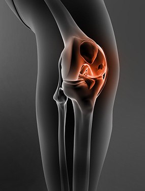 Fracture Treatment / Trauma